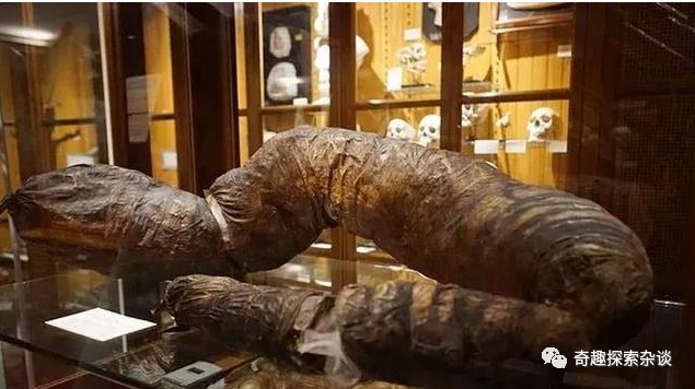 他三年没上大便活活憋死巨型大肠被放博物馆展览吸引百万游客