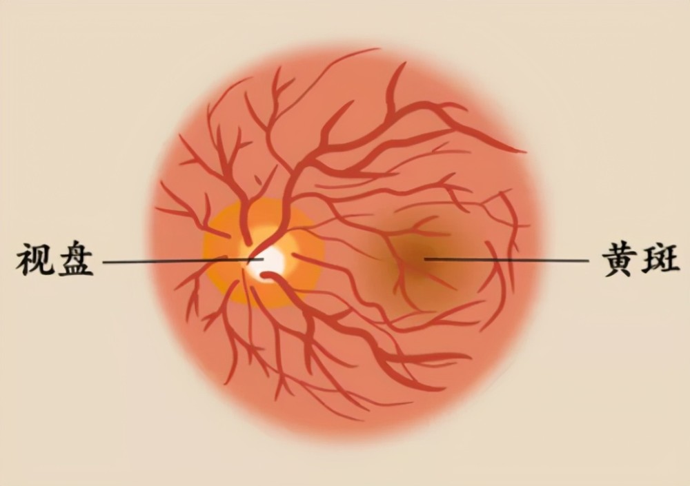 黄斑是眼底的中心部位一块很小的区域,黄斑在整个眼部构造中扮演着