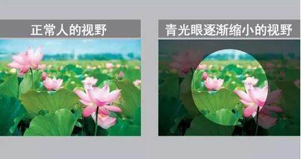 堵塞,眼压异常的疾病,患者焦点部分视野丢失,中后期发展成管状视野