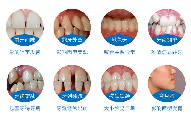 错过正畸黄金时期,成年人做矫正会导致牙齿松动脱落吗?