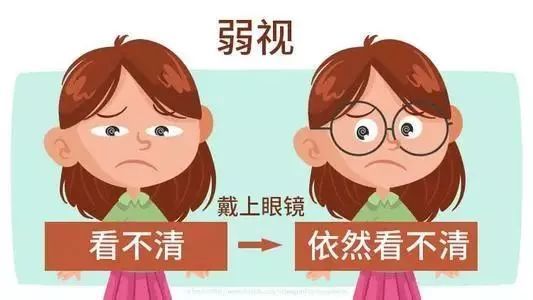 还会影响智力|弱视|智力|弱视眼