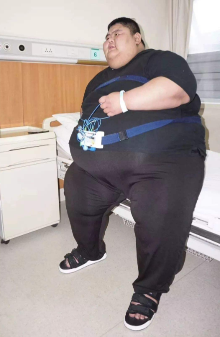 被称"中国第一胖",为爱一年从668斤减到268斤,变身网红