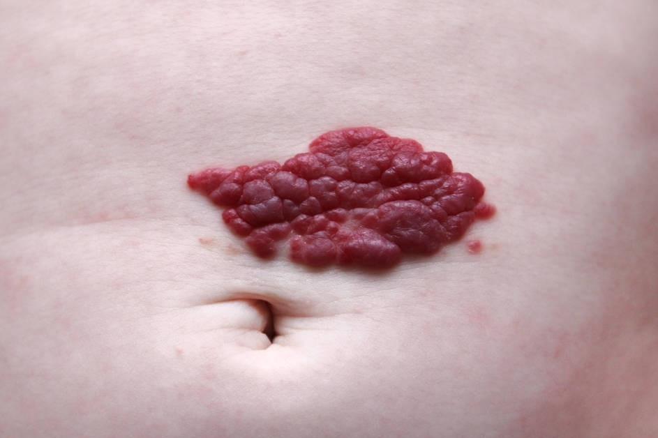内部发生一定的病变,通过血管在人们皮肤上显示出类似于红色的小点
