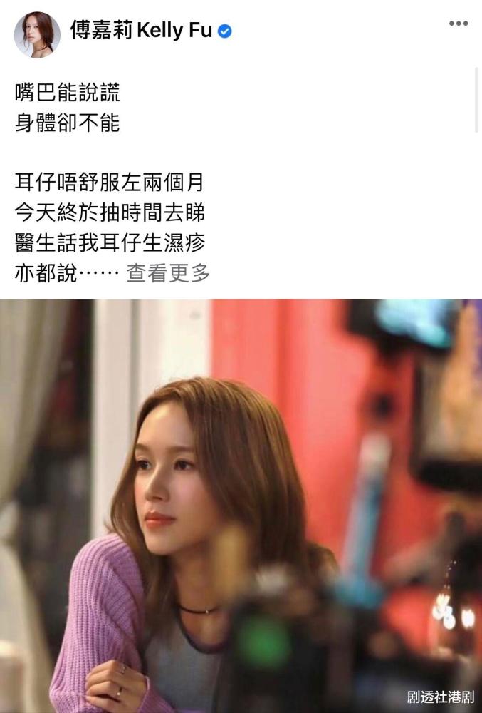 体重跌至88斤!tvb小花傅嘉莉压力大,耳朵患湿疹,健康令人担心