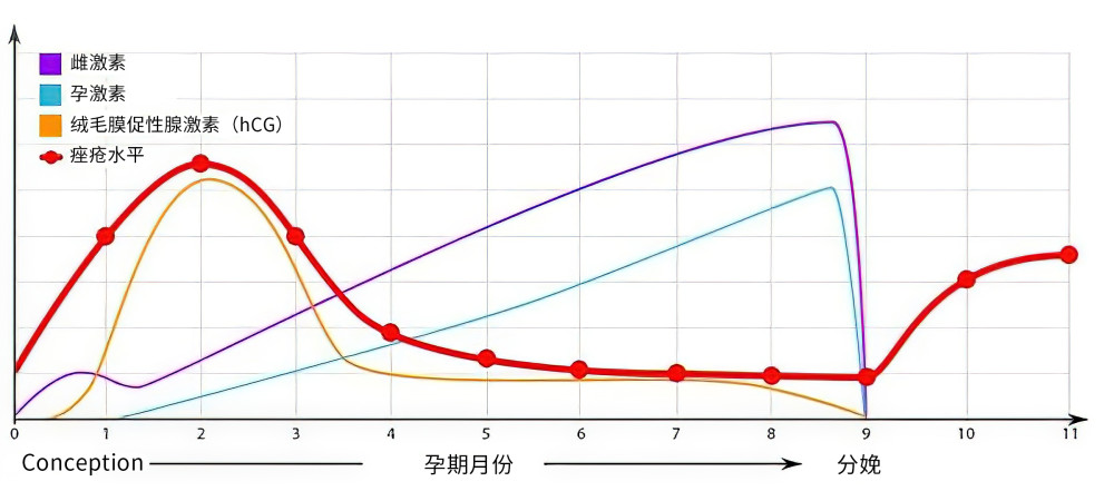 类风湿关节炎在妊娠期的病情变化,和患者体内性激素的变化有关.