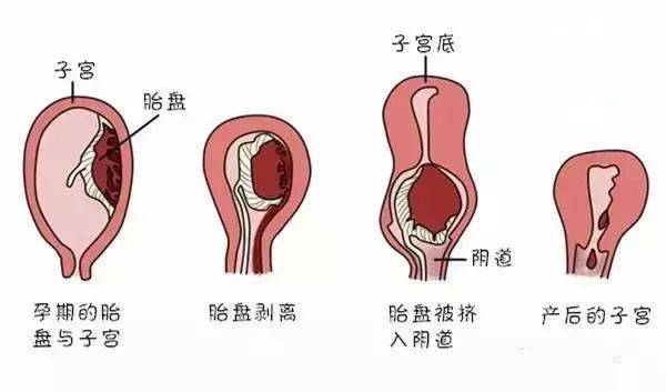 生完孩子后,恶露排不干净的原因,孕妈如何正确护理保养