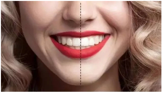当出现上述牙齿咬合不正常问题时,可根据不同的咬合症状采用不同的