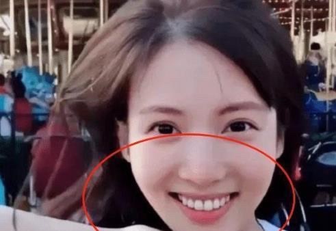 金晨的脸整容痕迹明显,为何还能艳压其他女明星们