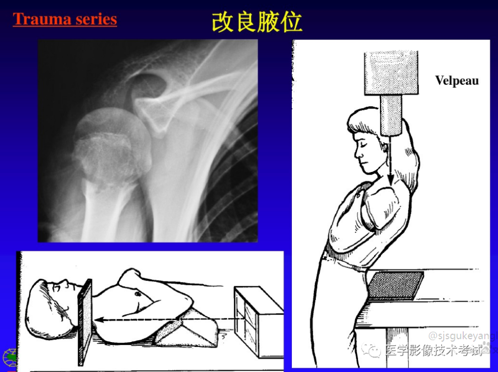 肩关节特殊体位,很多是你没见过的哦!