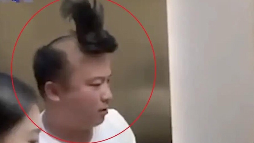 男子因为假发片脱落尴尬不愿意上班