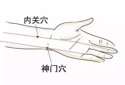 上肢可依次按压神门,内关,后溪,列缺等穴位周围酸麻胀痛的敏感点.1.