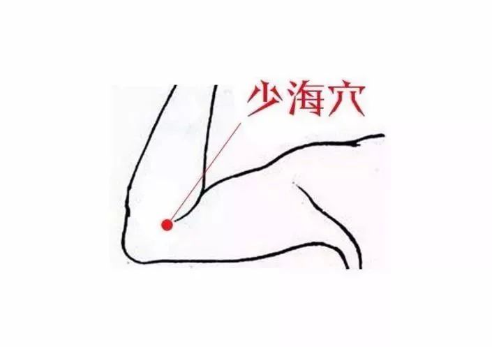 腹痛 上肢可依次按压 曲池,少海,尺泽,曲泽等穴周围酸麻胀痛的敏感点.