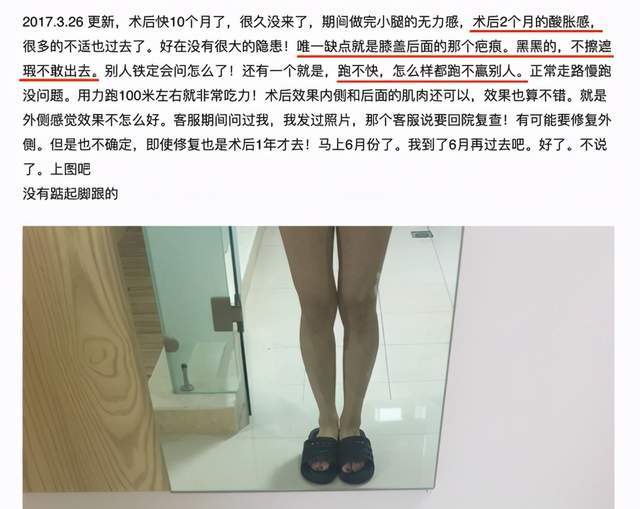 断筋瘦腿断骨增高精灵耳女孩请停止排队自残