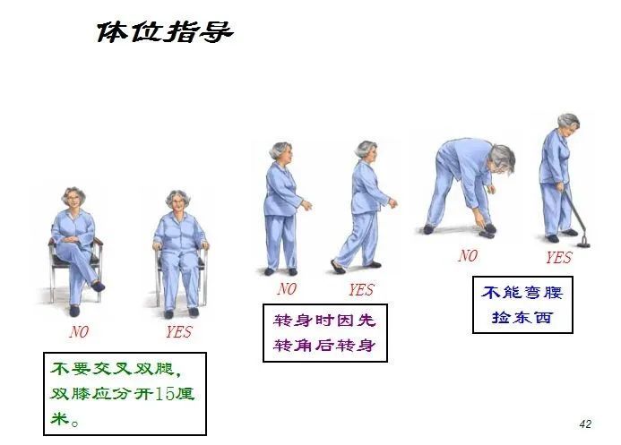 骨折术后的康复功能锻炼(含上肢,下肢)