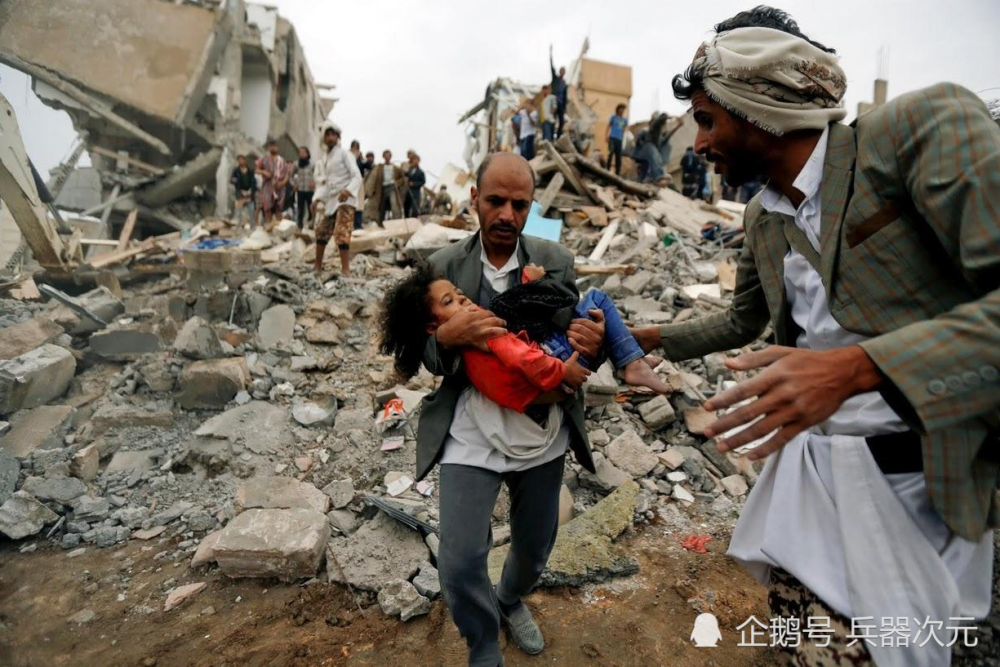 遭遇袭击受伤的也门儿童