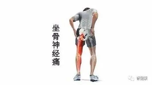 不是腰突!而是这块肌肉在求救!