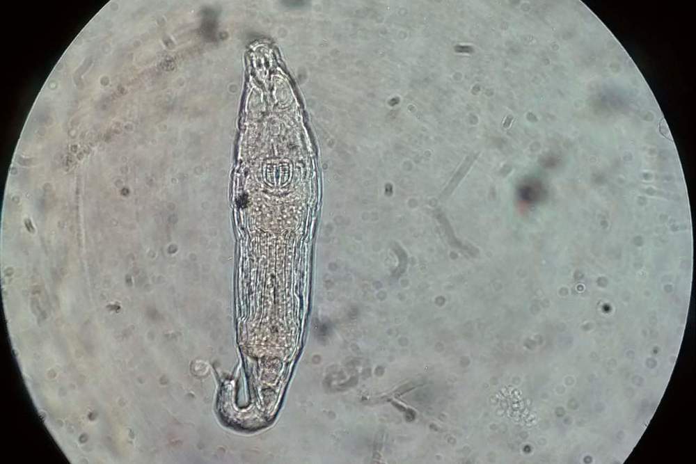 在过去科学家们认为蛭形轮虫只能在冰冻中存活上千年,但俄罗斯团队的