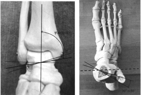 足外侧缘抬高内侧缘降低,足尖朝外称为旋前;发生部位主要在跗跖关节