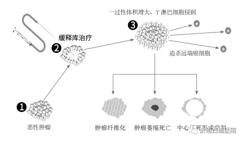 左肺癌患者经保法医院缓释库超微创靶向治疗生存超过6年