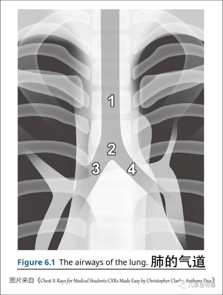 deviated septum, (1) 偏向病侧( deviatedtowards di