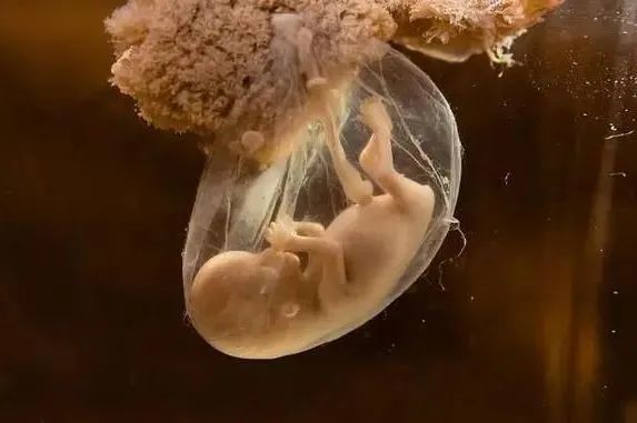 孕期做过四维彩超后,胎儿还有可能是畸形吗?