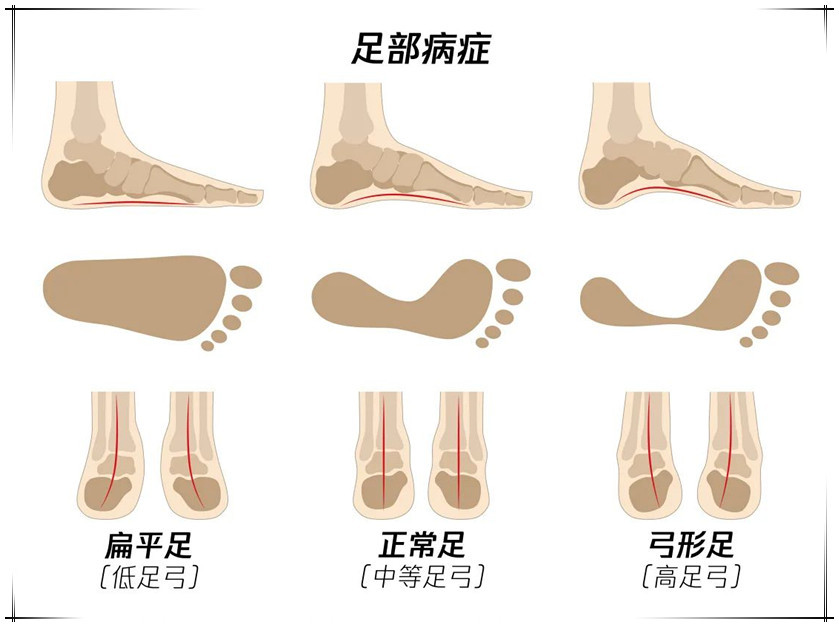 家长带孩子"泡脚",或会耽误娃的脚部发育,现在改还来得及