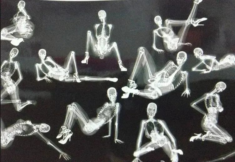 也可以找个拍x光的 露骨但不色情