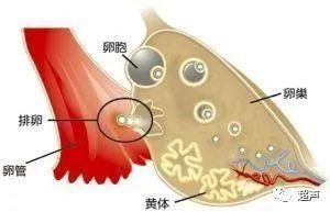 黄体功能不全到底是个什么东西