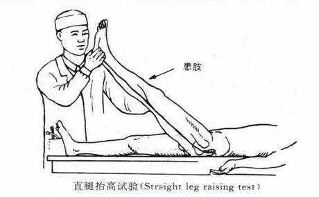 腰椎间盘突出的体格检查