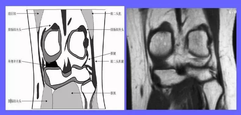 面第9层mri冠状面第10层横断面横断面提供了一组膝关节断面的基本图象