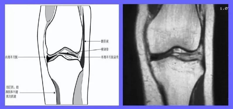 mri冠状面第1层 横断面 横断面提供了一组膝关节断面的基本图象,可