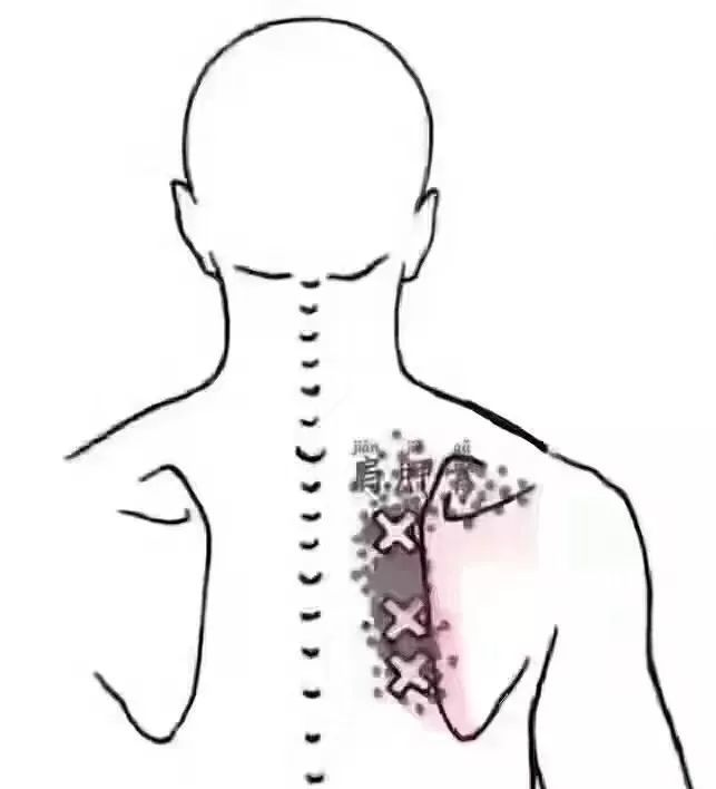 来源微信公众号:学经络 肩胛骨疼痛的鉴别方法 ★ 测测你属于哪种?
