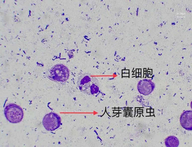 人芽囊原虫,你是夜空中最亮的星