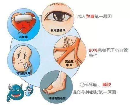 中科西部研究院:干细胞治疗糖尿病并发症有望攻克!