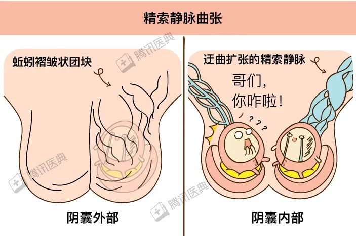 男生的蛋蛋最怕什么?我们总结了5大事故现场,发现