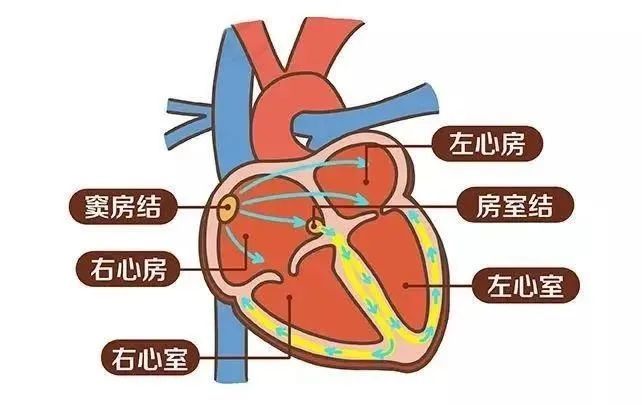 百万医疗险报不报销心脏起搏器?分3种情况!