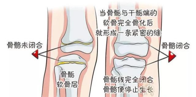 总是担心孩子长不高?但你知道孩子是如何长高的吗!