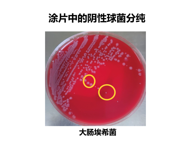 阅片及"慧眼识菌"病例经验报告临床危急值 报告临床:找到革兰阳性球菌