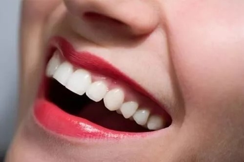 24岁美国女子曾拥有 "完美微笑",但牙齿在4年内几乎掉
