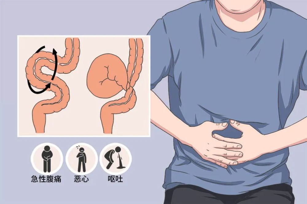 军医讲堂丨警惕肠扭转,饭后运动需科学