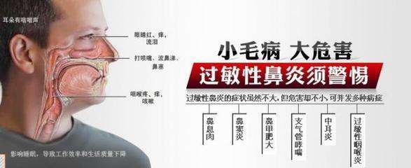 知道过敏性鼻炎的临床症状,才能更好防治