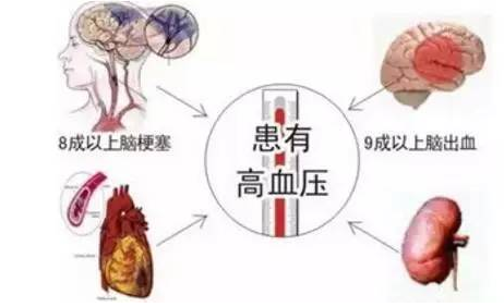 高血压性脑出血治疗原则