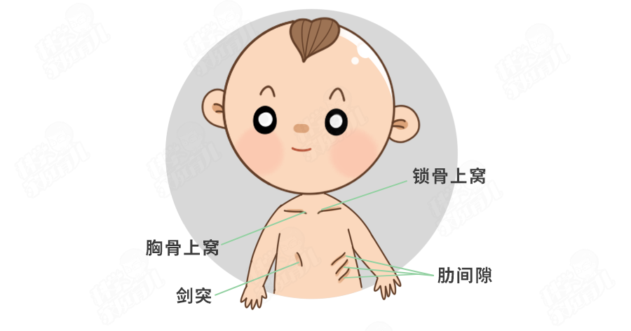 三凹征同样也要注意宝宝的状态, 哭闹或者活动也会对观察效果产生影响