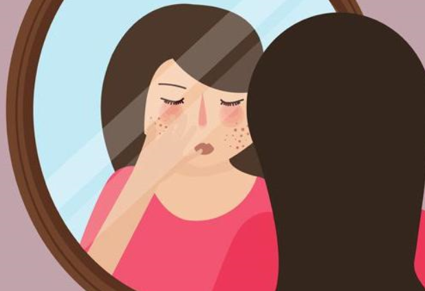 说了你可能不信黄褐斑最爱偷袭好女人