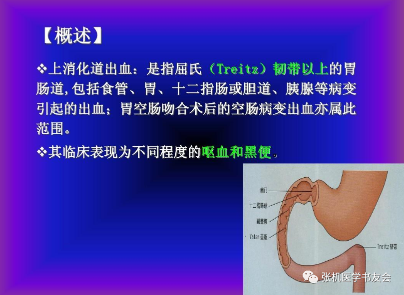 上消化道出血是指屈氏韧带以上的消化道,包括食管,胃,十二指肠或胰,胆