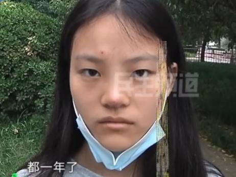 "朋友说我是一只米老鼠"郑州一女子整鼻后鼻头发黑崩溃诉说