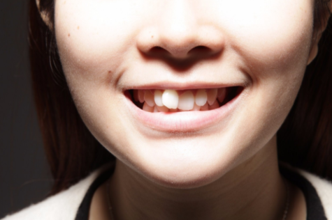 昌平矫正门牙突出有哪些方法 国医康|昌平|牙齿|牙套|牙齿畸形