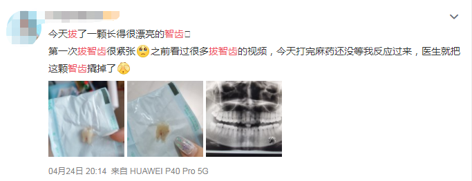 这几种智齿不疼也得拔,否则后果很严重!快看看你长了没