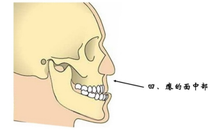 有些"地包天"孩子的面中部是凹,瘪进去的第二步,看侧脸像这样上排门牙