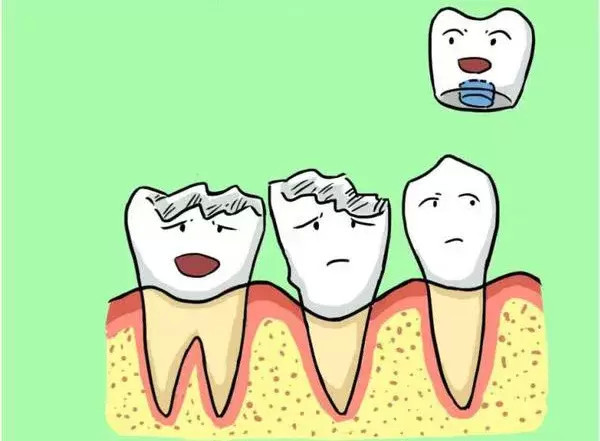拔掉是不可能的论残牙根正确的处理方式